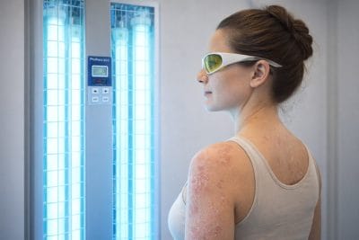 Woman being treated for Psoriasis