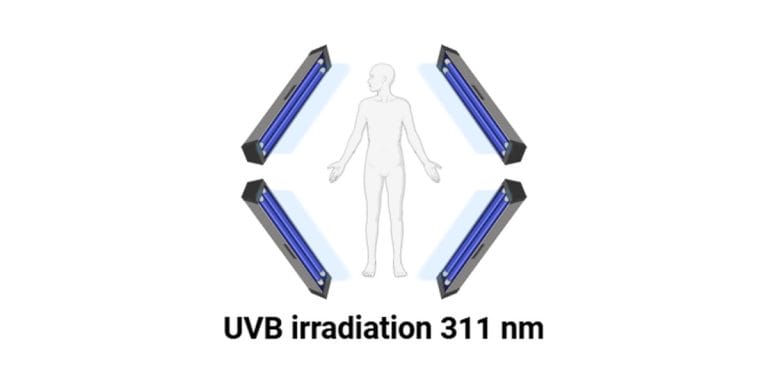 Narrowband UVB Changed Immune Cells Far From The Skin. In MS, Less Of The Signal Got Through.